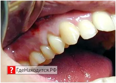 Где находятся слюнные железы у человека? железа