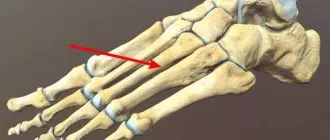 плюсневая кость расположение анатомия